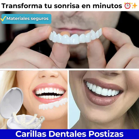 Carillas Dentales Monturas - ¡Sonrisa Perfecta al Instante! 😁🦷